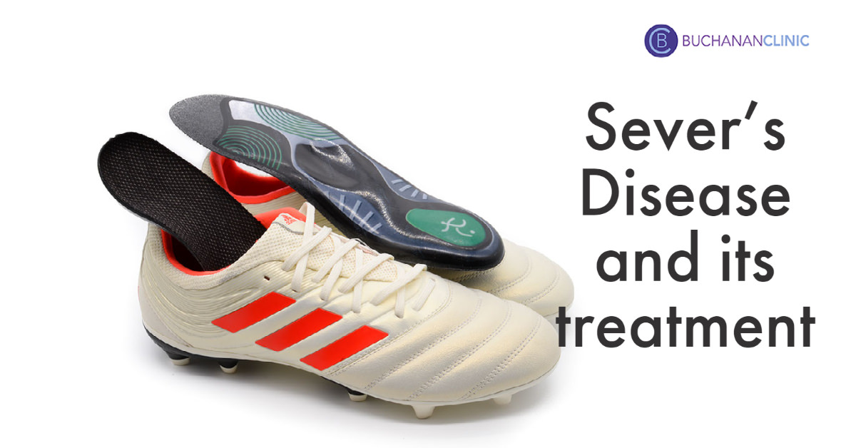 Sever's disease insoles new arrivals